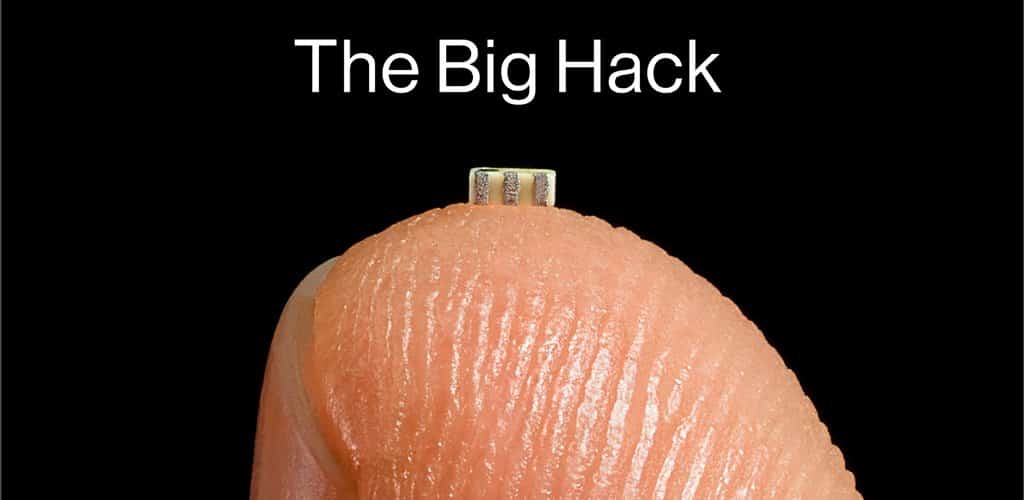 big hack